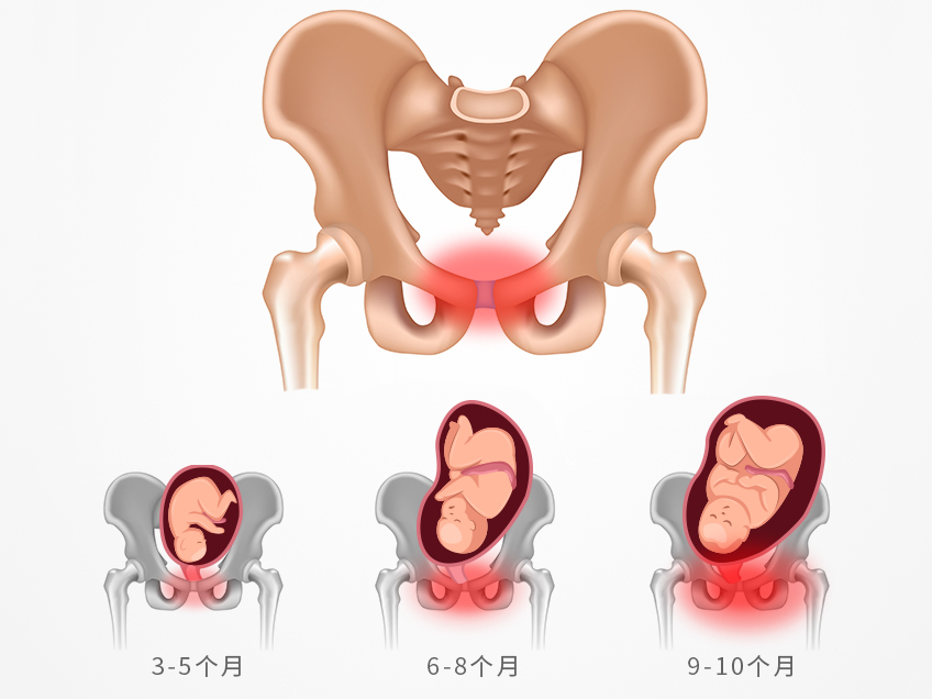 孕妈咪会容易便秘或患上痔疮吗