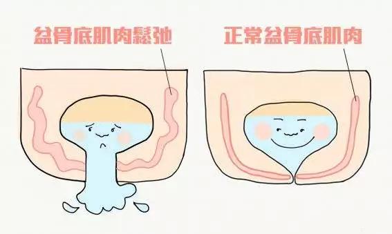 浮肿程度与肾脏病严重与否不成正比