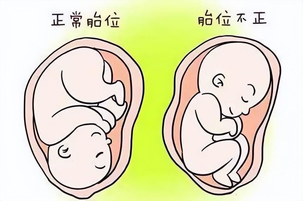准妈妈，哪些东西尽量少吃
